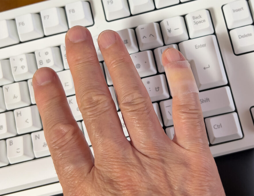 へバーデン結節か？