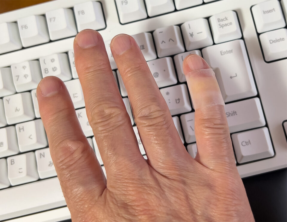 へバーデン結節か？